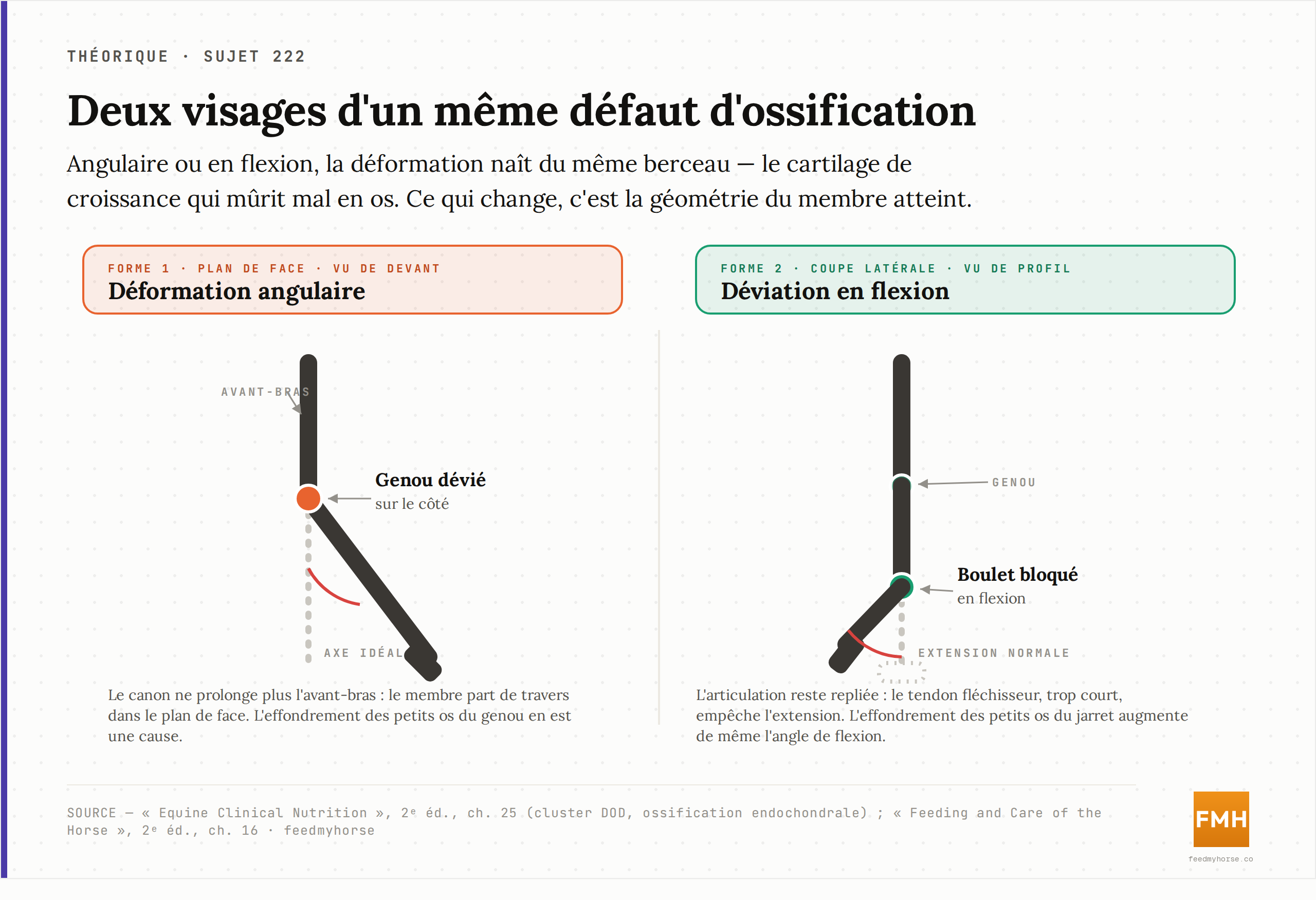 Les deux visages d'un même défaut d'ossification : à gauche, la déformation angulaire (le membre dévie dans le plan de face) ; à droite, la déviation en flexion (l'articulation reste bloquée en flexion). Toutes deux naissent d'une ossification endochondrale perturbée dans le cartilage de croissance. Source : Equine Clinical Nutrition, 2ᵉ éd., ch. 25 ; Feeding and Care of the Horse, 2ᵉ éd., ch. 16.