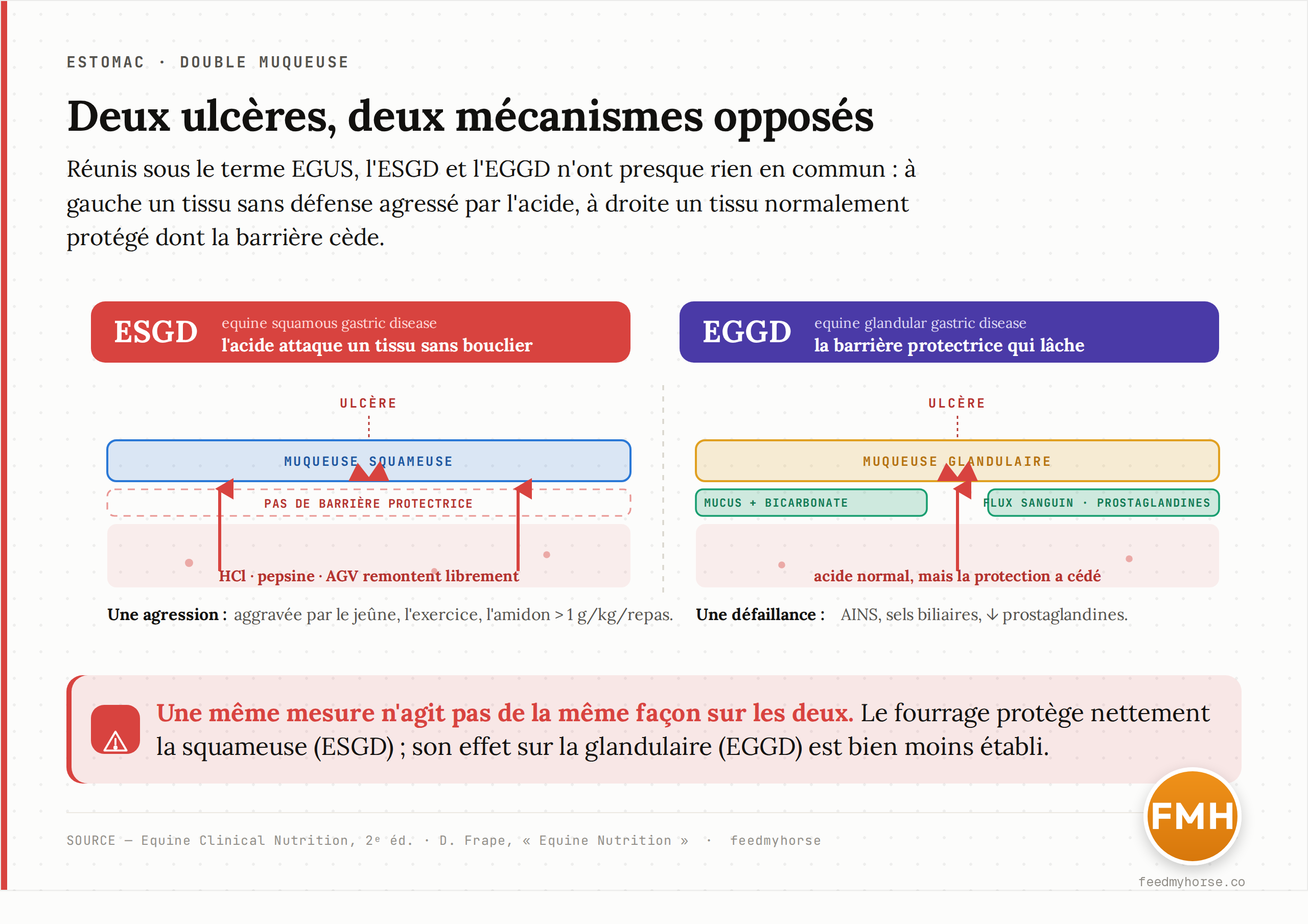 Comparaison des deux mécanismes. À gauche, l'ESGD : l'acide, la pepsine et les AGV remontent et attaquent une muqueuse squameuse dépourvue de barrière mucus/bicarbonate. À droite, l'EGGD : la muqueuse glandulaire produit normalement l'acide mais sa barrière protectrice (mucus, bicarbonate, flux sanguin, prostaglandines) cède, laissant une brèche. Deux causes opposées : agression contre la squameuse, défaillance de la protection dans la glandulaire.